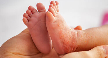 Dermatologia pediatrica